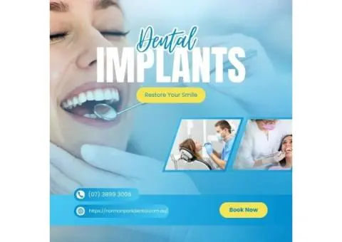 Affordable Dental Implants Camp Hill – Norman Park Dental Surgery