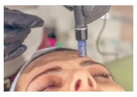 Advanced Skin Needling Therapy in Gold Coast for Smooth Skin - 1/4