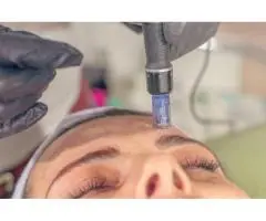 Advanced Skin Needling Therapy in Gold Coast for Smooth Skin