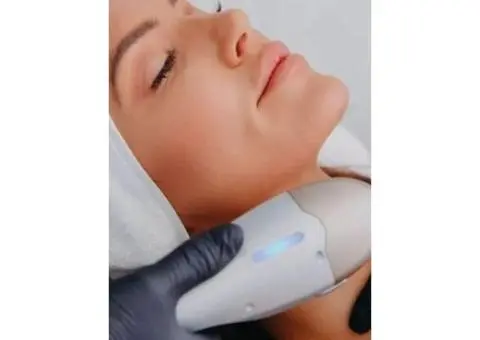 Microneedling Double Bay