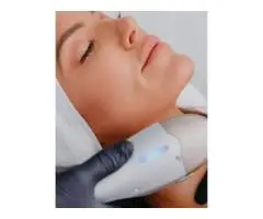 Microneedling Double Bay