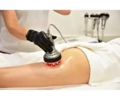 Luxury Anti Cellulite Treatment in Gold Coast – Miami Kiss International