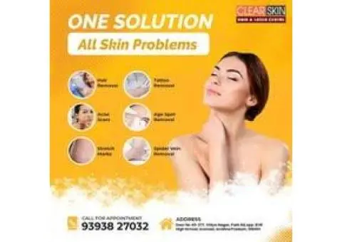 Best Advanced Xanthelasma Treatment in india