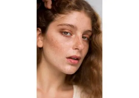 Common Myths vs. Facts About Pigmentation Removal in Sydney