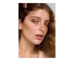 Common Myths vs. Facts About Pigmentation Removal in Sydney