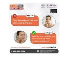 Best Advance Syringoma Treatment in india