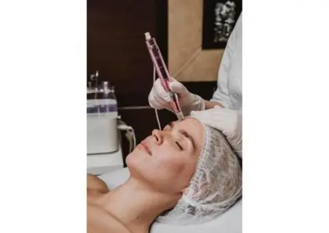 7 Aftercare Tips After Microneedling in Sydney for Faster Healing