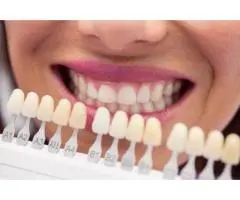 Teeth Whitening Brunswick | Hope Street Family Dental