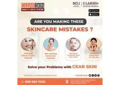 Best Birthmark removal laser treatment in india