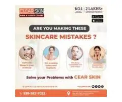 Best Birthmark removal laser treatment in india