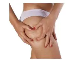 Professional Cellulite Reduction Treatment for Smoother & Firmer Skin