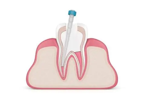 Trusted Family Dentist in Bella Vista – Gentle, Modern Dental Care - 4/5