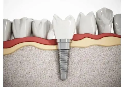 Trusted Family Dentist in Bella Vista – Gentle, Modern Dental Care - 5/5