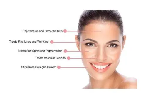 Acne Treatment in Upper Mount Gravatt