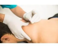 Holistic Healing Acupuncture Perth | Floreat