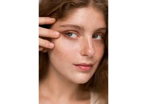 Why winter is secretly the best season for pigmentation removal in Sydney