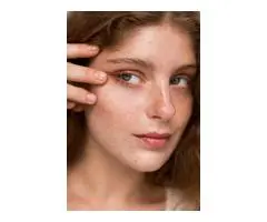 Why winter is secretly the best season for pigmentation removal in Sydney