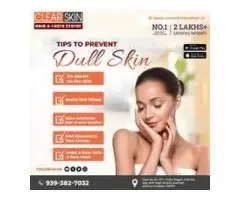 portwine stain treatment in india