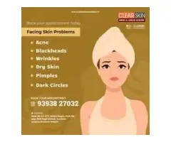 Laser Treatment For Birthmark Removal In India