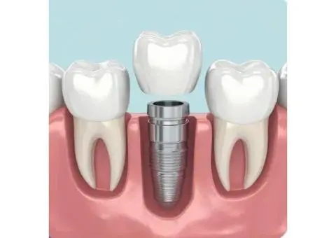 Root Canal Treatment Penrith