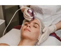 Thermage FLX Sydney – Advanced Non-Surgical Skin Tightening Treatment