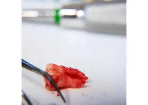 Affordable Wisdom Teeth Melbourne Services