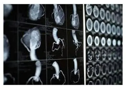 Cardiac CT scan Mickleham