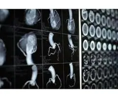 Cardiac CT scan Mickleham