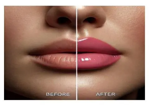 Advanced Face & Skin Treatment for Pigmentation Removal - 5/8