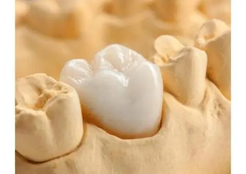 Teeth Whitening Near Croydon | The Good Dentists Group - 5/10