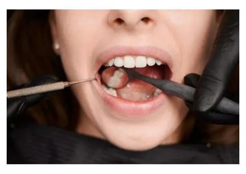 Gentle and Effective Broken Tooth Treatment in Melbourne