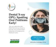 Dental X-ray (OPG): Spotting Oral Problems Early at Crystal Radiology. (02) 8315 8292