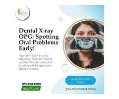 Dental X-ray (OPG): Spotting Oral Problems Early at Butler Medical Imaging. (08) 9544 3999