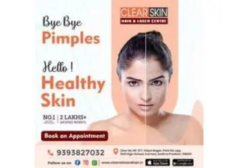 Best Advanced Xanthelasma Treatment in india