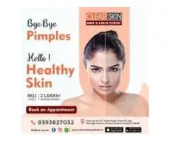 Best Advanced Xanthelasma Treatment in india