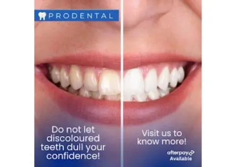 Teeth Whitening Baulkham Hills – Prodental Clinic