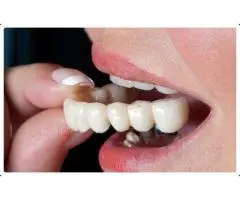 Root Canal Treatment: Best Practices Recommended by Dentists