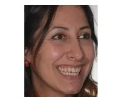 Where Can You Find Porcelain Teeth Melbourne?