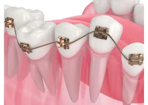 Emergency Dentist Bella Vista – Fast, Reliable Dental Care - 4/6