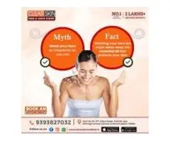 Best Acne Scar Laser Treatment  In India