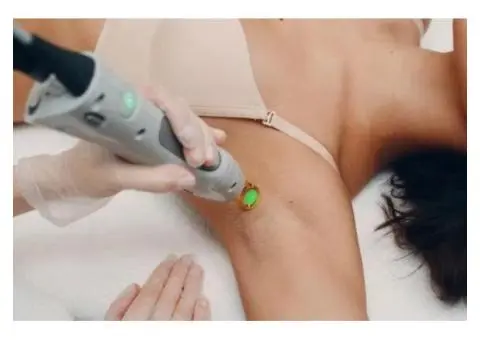 Professional Laser Hair Removal in Sydney – NobleSkin Laser Clinic