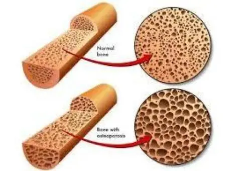 Bone Mineral Craigieburn