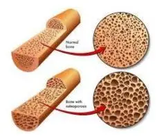 Bone Mineral Craigieburn