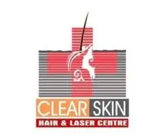 best pulsed dye laser treatment in india