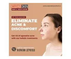 Laser Treatment For Birthmark Removal In India