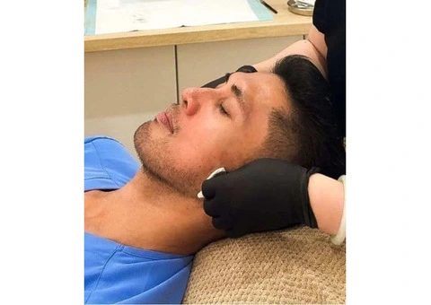 Microneedling Double Bay