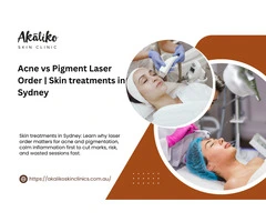 Laser for Acne vs Pigmentation in Sydney: Why the Order Matters