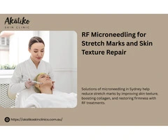 RF Microneedling in Sydney for Stretch Marks: Does It Work?