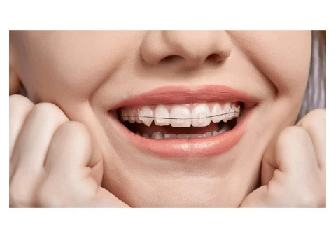 Braces Zetland - 1/3