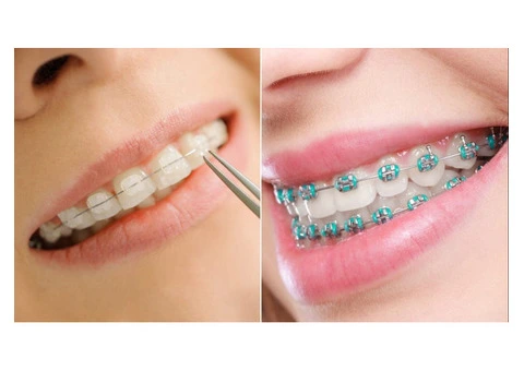 Braces Zetland - 3/3